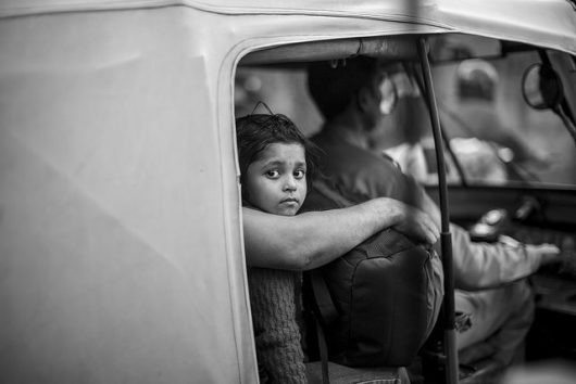 How One Organization is Ending Clubfoot in Developing Countries