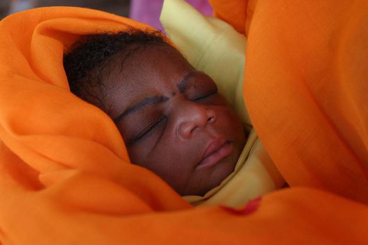 Life-Saving Treatment for Infant Hydrocephalus in Uganda