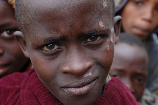 UNAIDS: Efforts to End HIV/AIDS in East and Southern Africa