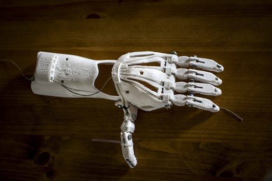 3-D-Printed Prosthetic Limbs