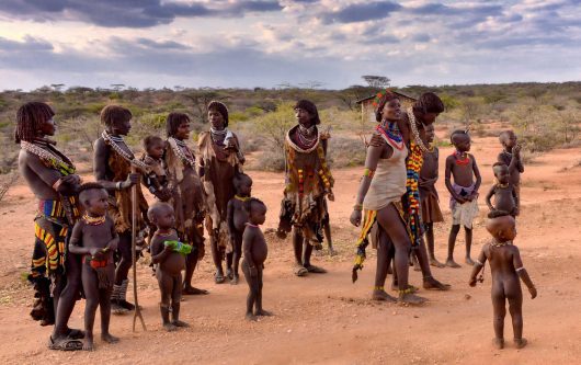 Diseases in Ethiopia