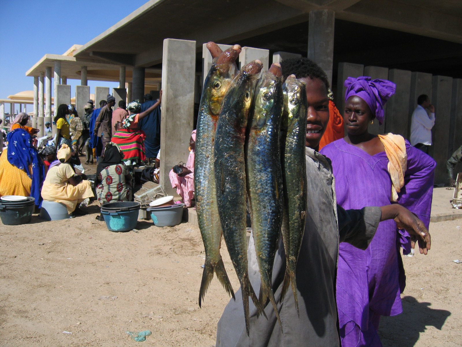 Malnutrition in Mauritania