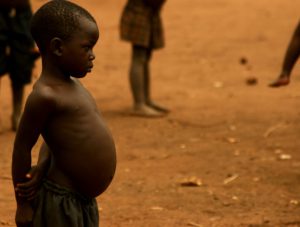 5 facts about hunger in Sudan