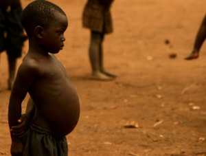 5 facts about hunger in Sudan