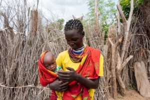 Finding Hope for Women with Fistula