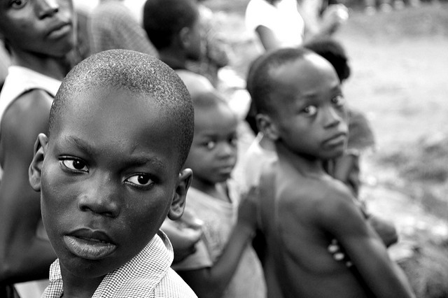 Malnutrition in Cameroon