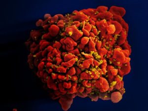 Mitchell Besser’s TED Talk on Mothers Helping Mothers Fight HIV