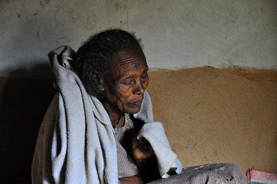 dementia in developing countries