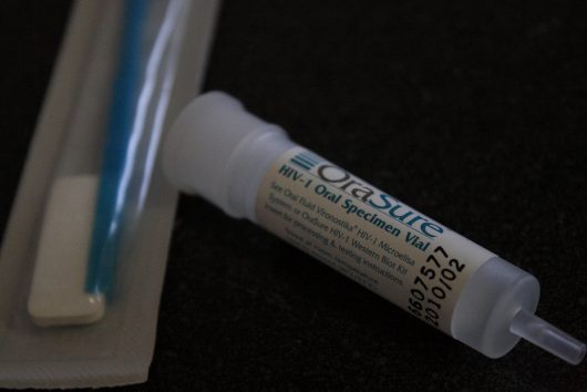 AIDS Today: Where Has the Aid Gone for AIDS?