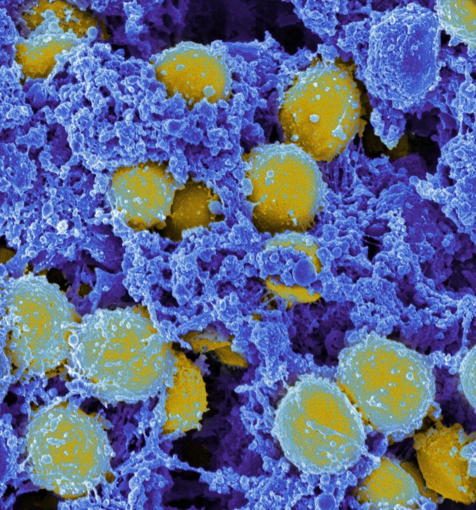 Antibiotic Resistance in Southeast Asia