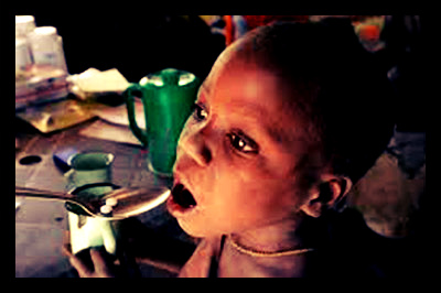 MDG