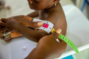 Childhood Anemia Prevention