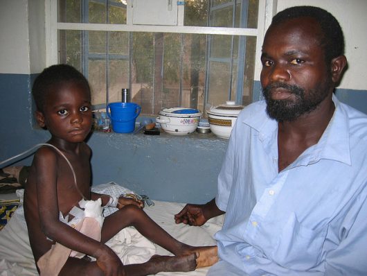 Common Diseases in Niger