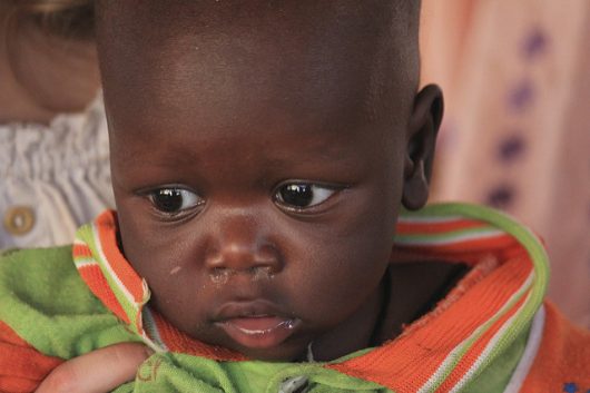 Common Diseases in Senegal