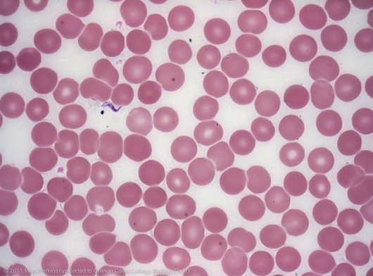 Common diseases in Paraguay