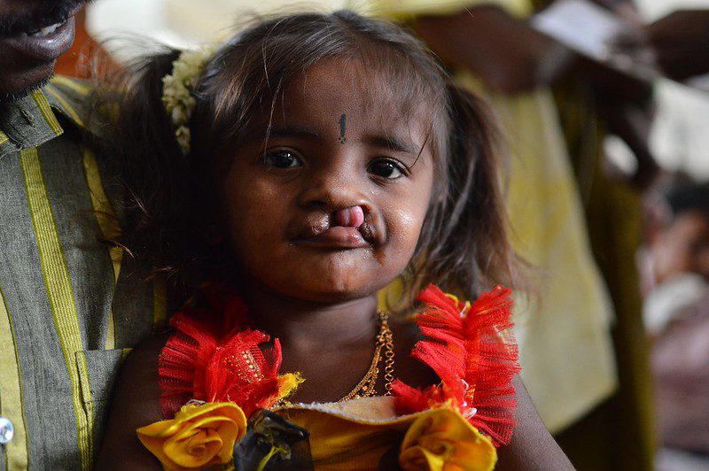 Congenital Anomalies