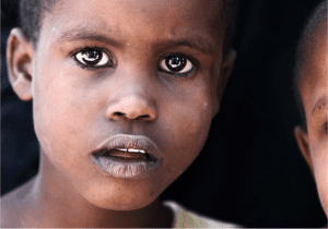 Diseases in Tanzania