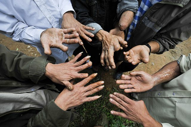 Effects of Cluster Bombs in Poor Countries