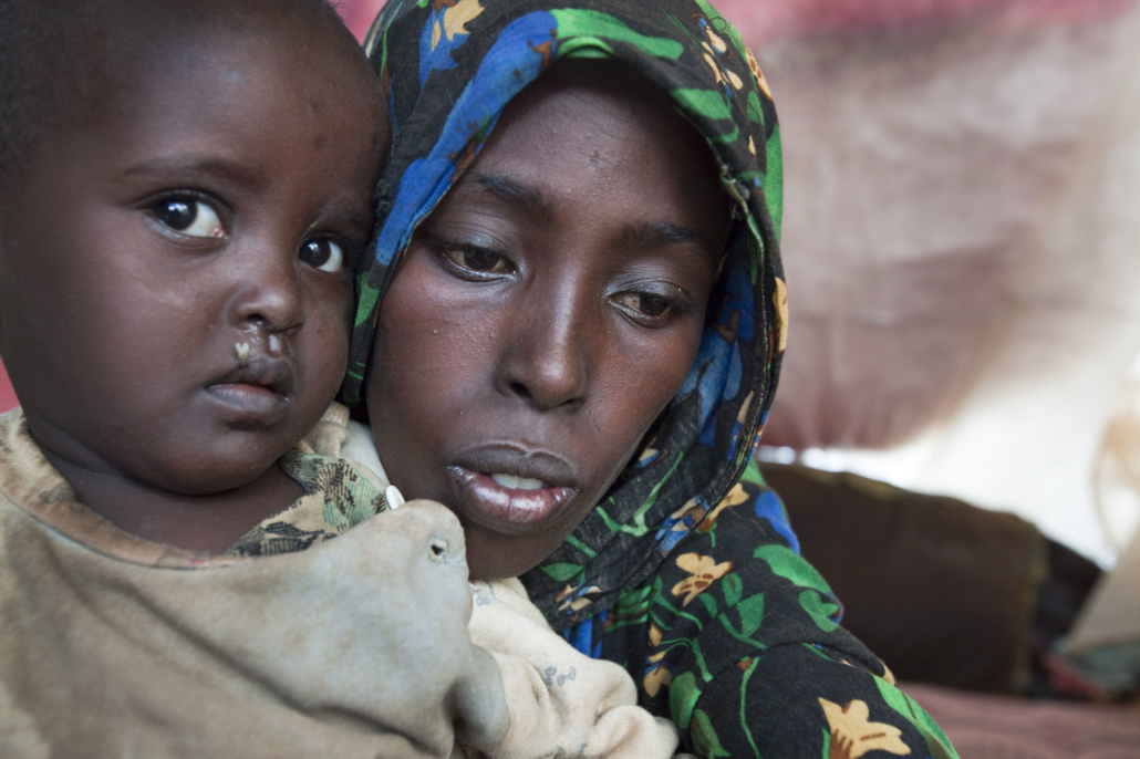 Drought in Ethiopia