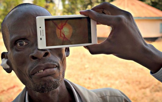 Eye Care in Kenya