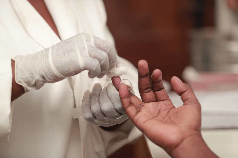 Global HIV Infections and Deaths Are Declining