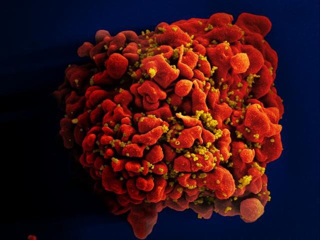 HIV and AIDS in South Africa