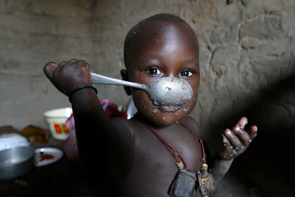 Healthcare in Central African Republic