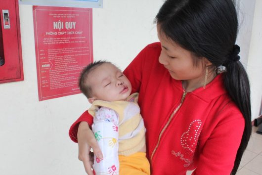 Increasing Surgical Care for Cleft Conditions