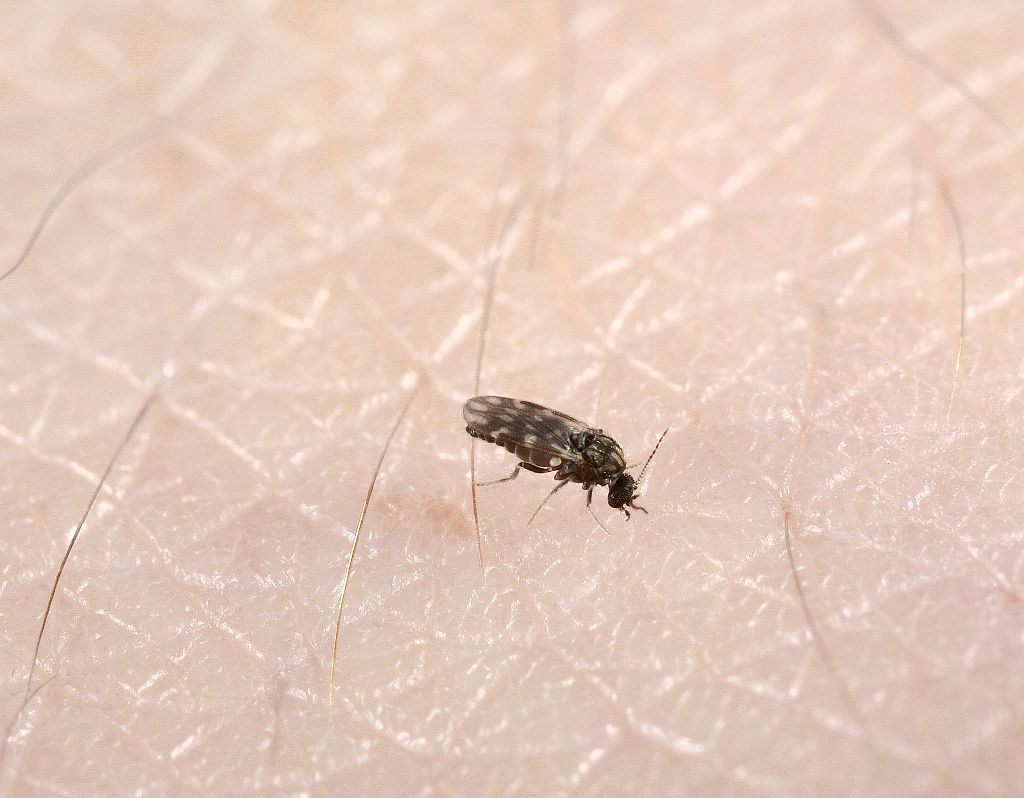 Kala Azar Disease