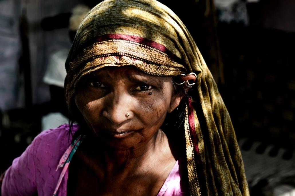 Leprosy in India