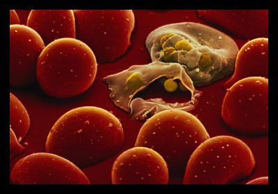 Malaria 101 Malaria 101 and Key Facts