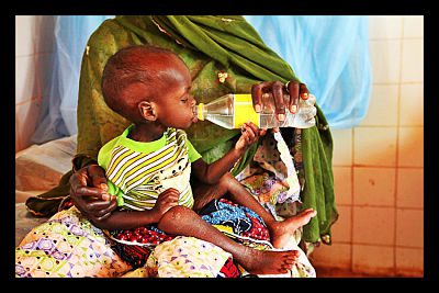 malnutrition_in_senegal