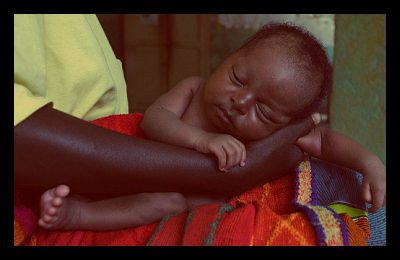 Nodding_Syndrome_in_Sudan_infants