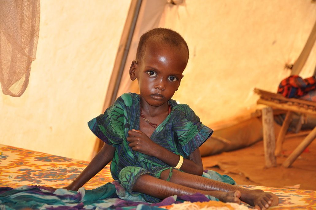 Stunted Growth in Children