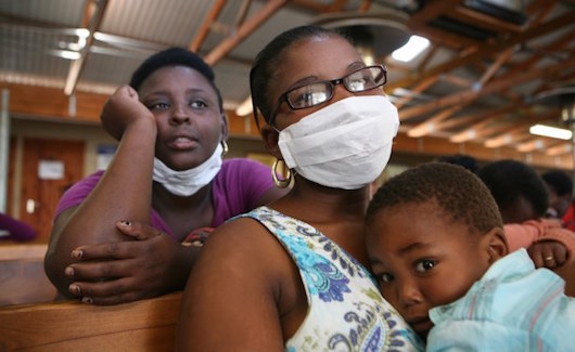 Tuberculosis