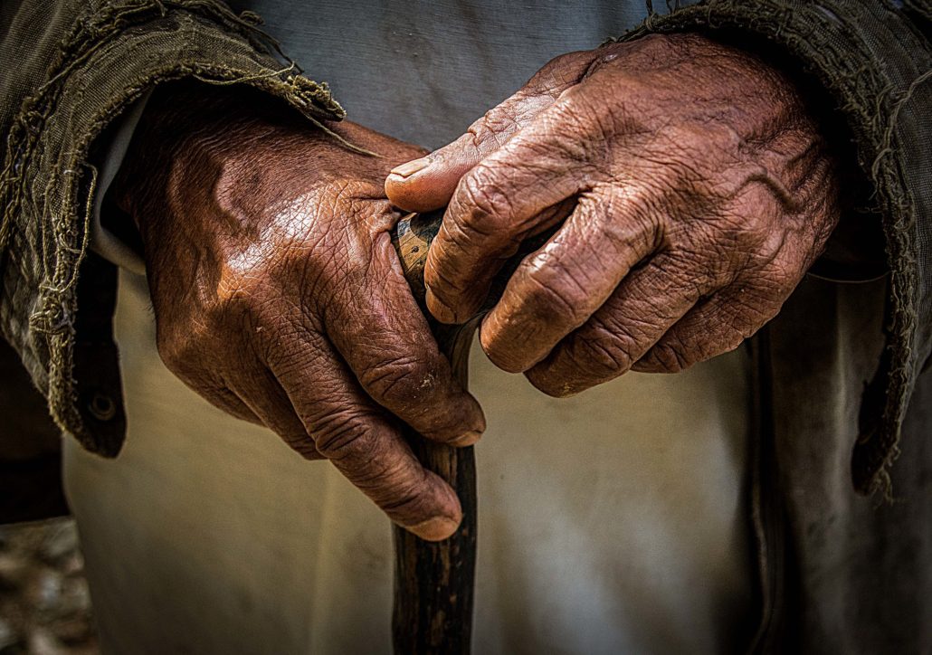 Leprosy Diagnosis