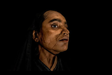 acid attacks