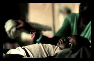 Bolus Endangers African Children Bolus, Outdated Medical Routine Endangers African Children