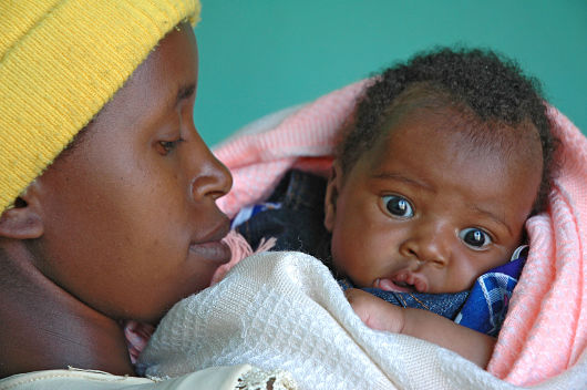 fetal_alcohol_syndrome
