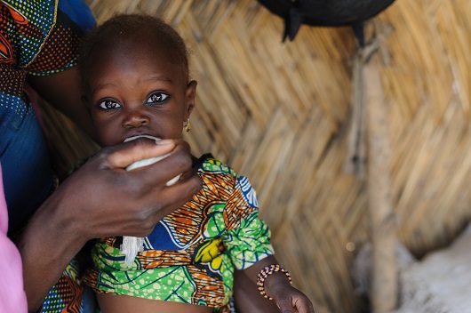 malnutrition_in_South_Sudan
