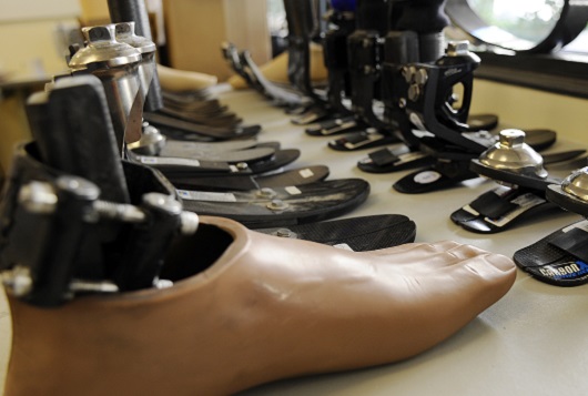 prosthetics for the poor