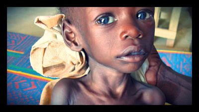 Stunting: Why Fighting Hunger is Important