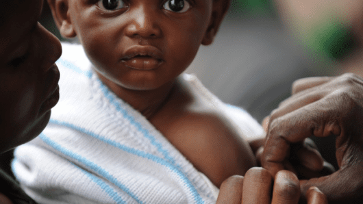 Measles_Outbreak