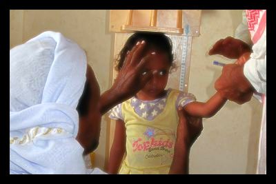 yemen_malnutrition